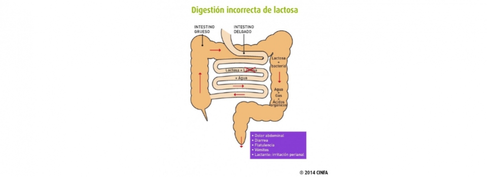 TE SIENTAN MAL LOS LACTEOS?