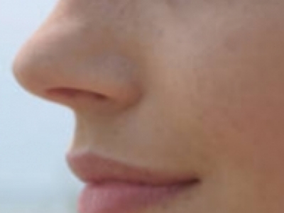 Consejos para sobrellevar la sequedad nasal