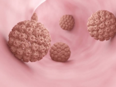 El Virus del Papiloma Humano (VPH): un desafío global 